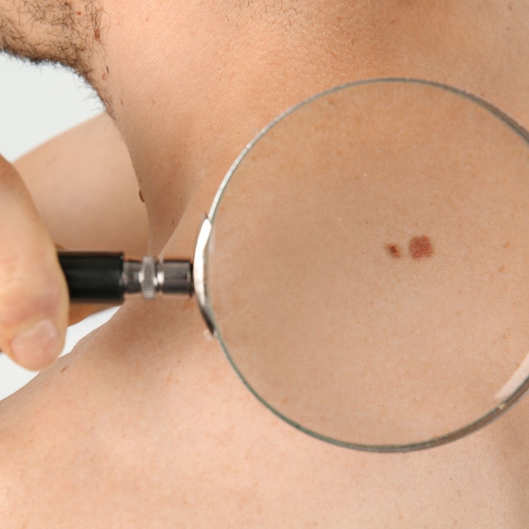 лікар-дерматолог Кропивницький, дерматолог Наталія Доценко, лікування шкіри Кропивницький, медичний центр Первинка