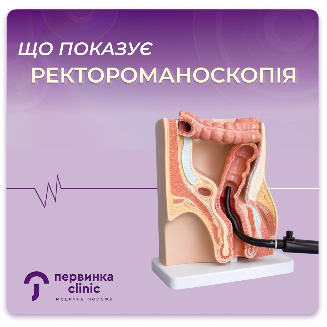 Обкладинка медичної мережі "Первинка". Що показує ректороманоскопія?