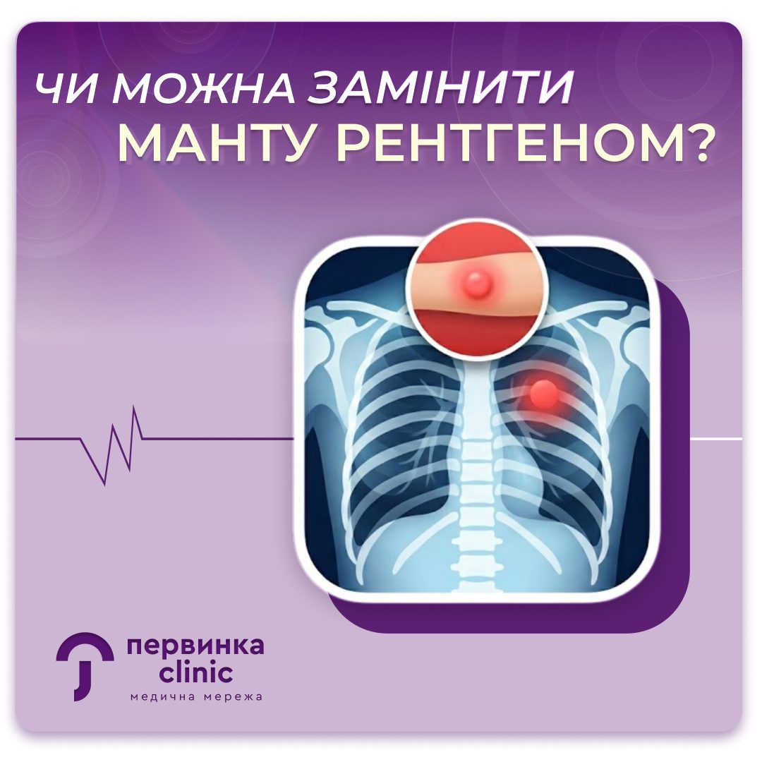 Обкладинка медичної мережі "Первинка". Чи можна замінити Манту рентгеном? Педіатри у Кривому Розі, Умані та Кропивницькому