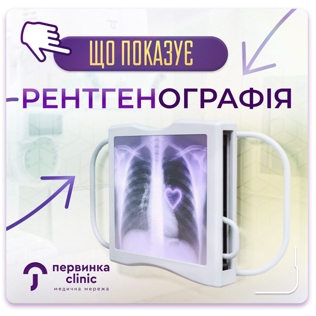 Обкладинка медичної мережі "Первинка". Рентген кабінет у Кривому Розі. Цифровиф рентген на 173 кварталі