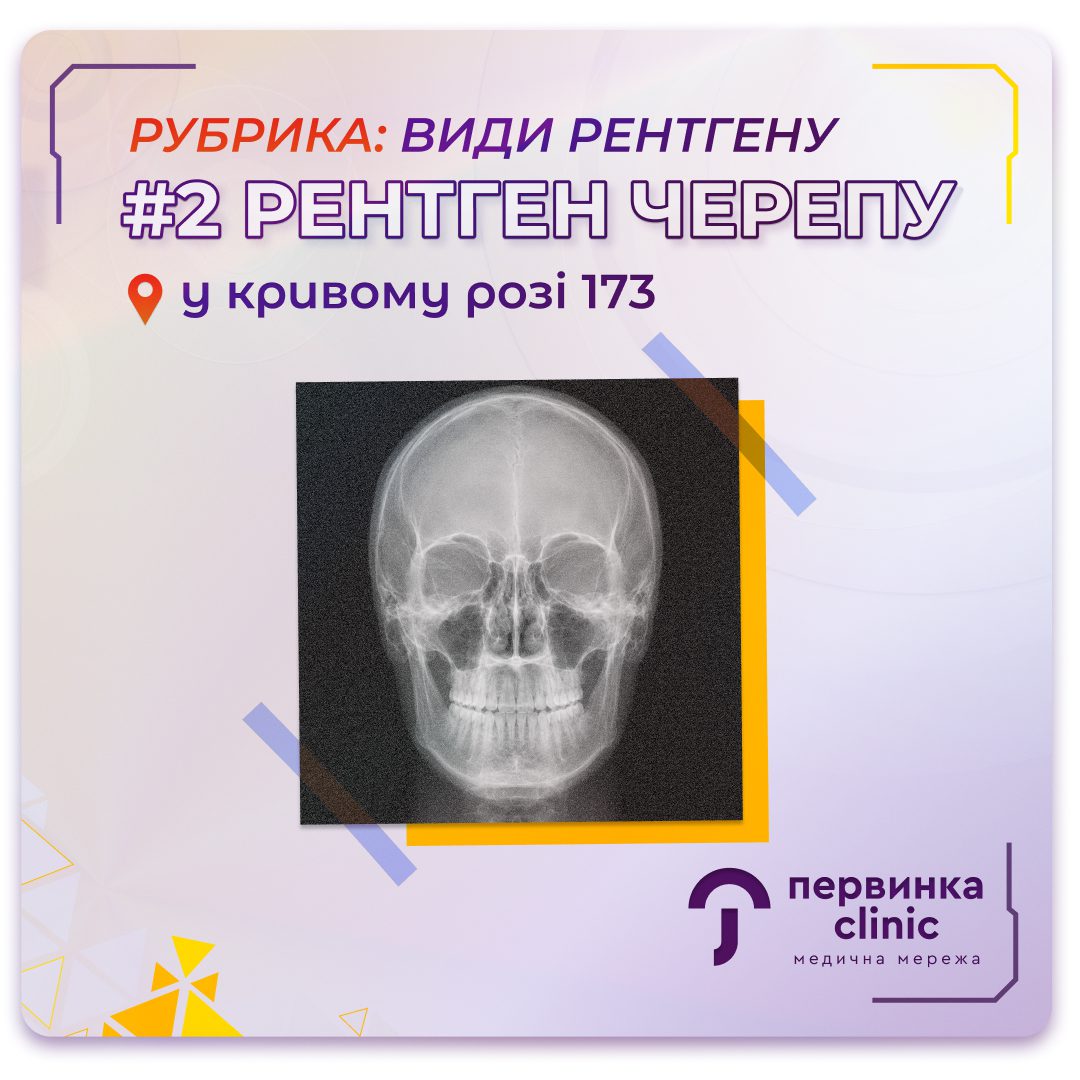Обкладинка медичної мережі "Первинка". Рубрика види рентгену. Кривий Ріг на 173 кварталі. Цифровий рентген. Рентген черепу. Чумак Олег травматолог