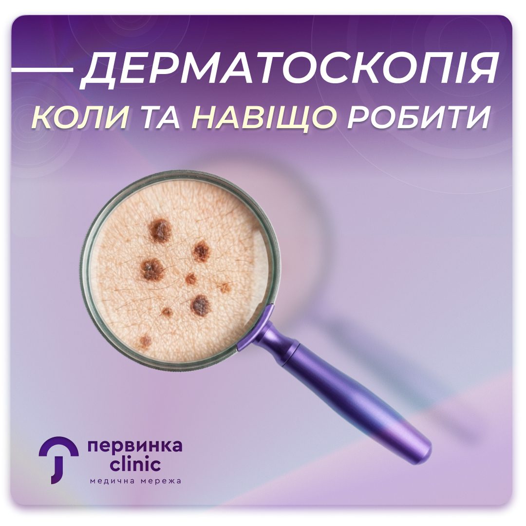 Обкладинка медичної мережі "Первинка". Дерматоскопія коли та навіщо робити. Догляд та обстеження за родимками. Дерматологи у місті Кривий Ріг, Умань та Кропивницький