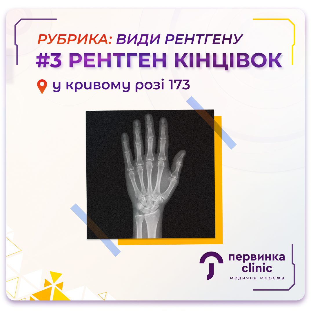 Обкладинка медичної мережі "Первинка". Рубрика види рентгену. №3 Рентген кінцівок. Цифровий рентген апарат у Кривому Розі на 173 кварталі. Рентгенографія у "Первинці"