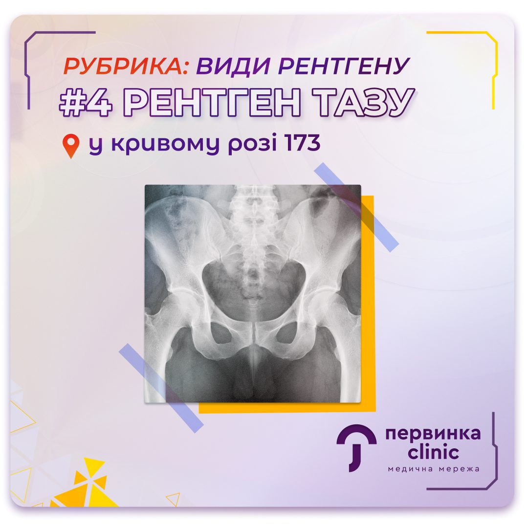 Обкладинка медичної мережі "Первинка". Рубрика види рентгену. №4 Рентген тазу. Цифровий рентген апарат у Кривому Розі на 173 кварталі. Рентгенографія у "Первинці"