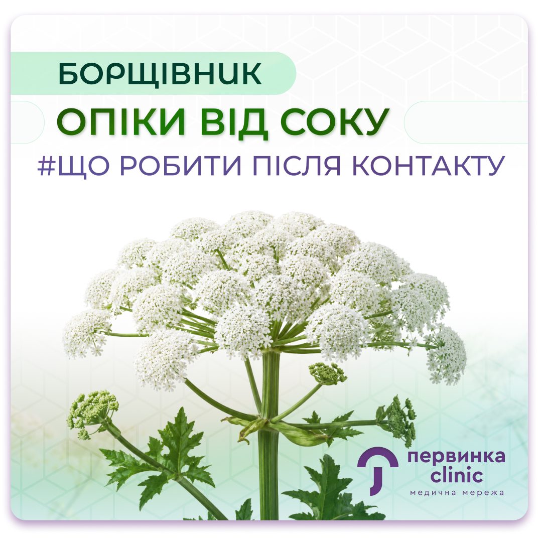 Обкладинка медичної мережі "Первинка". Борщівник, опіки від його соку. Що робити при опіку борщівником? Дерматологи у Кривому Розі, Умані та Кропивницькому