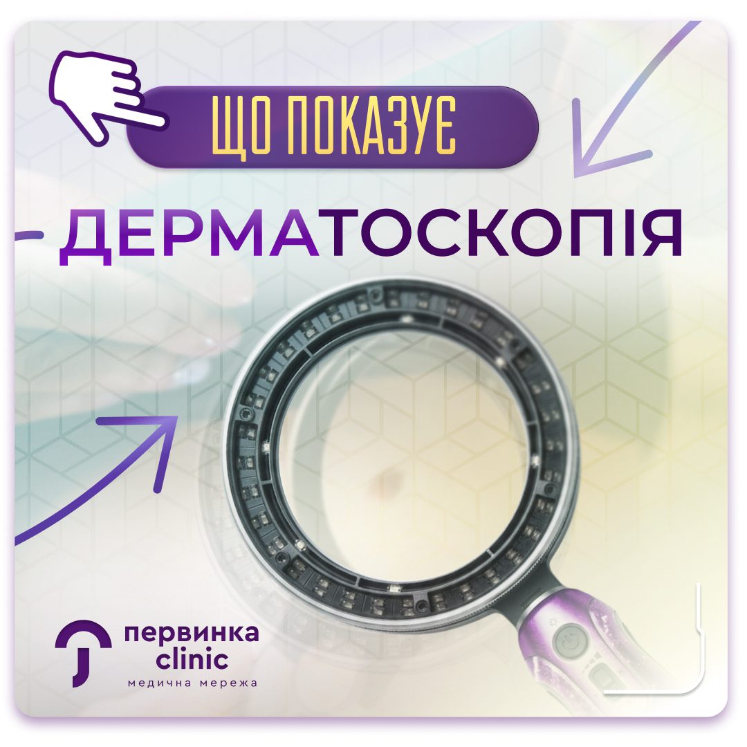 Обкладинка медичної мережі "Первинка". Дерматоскопія коли та навіщо робити. Догляд та обстеження за родимками. Дерматологи у місті Кривий Ріг, Умань та Кропивницький