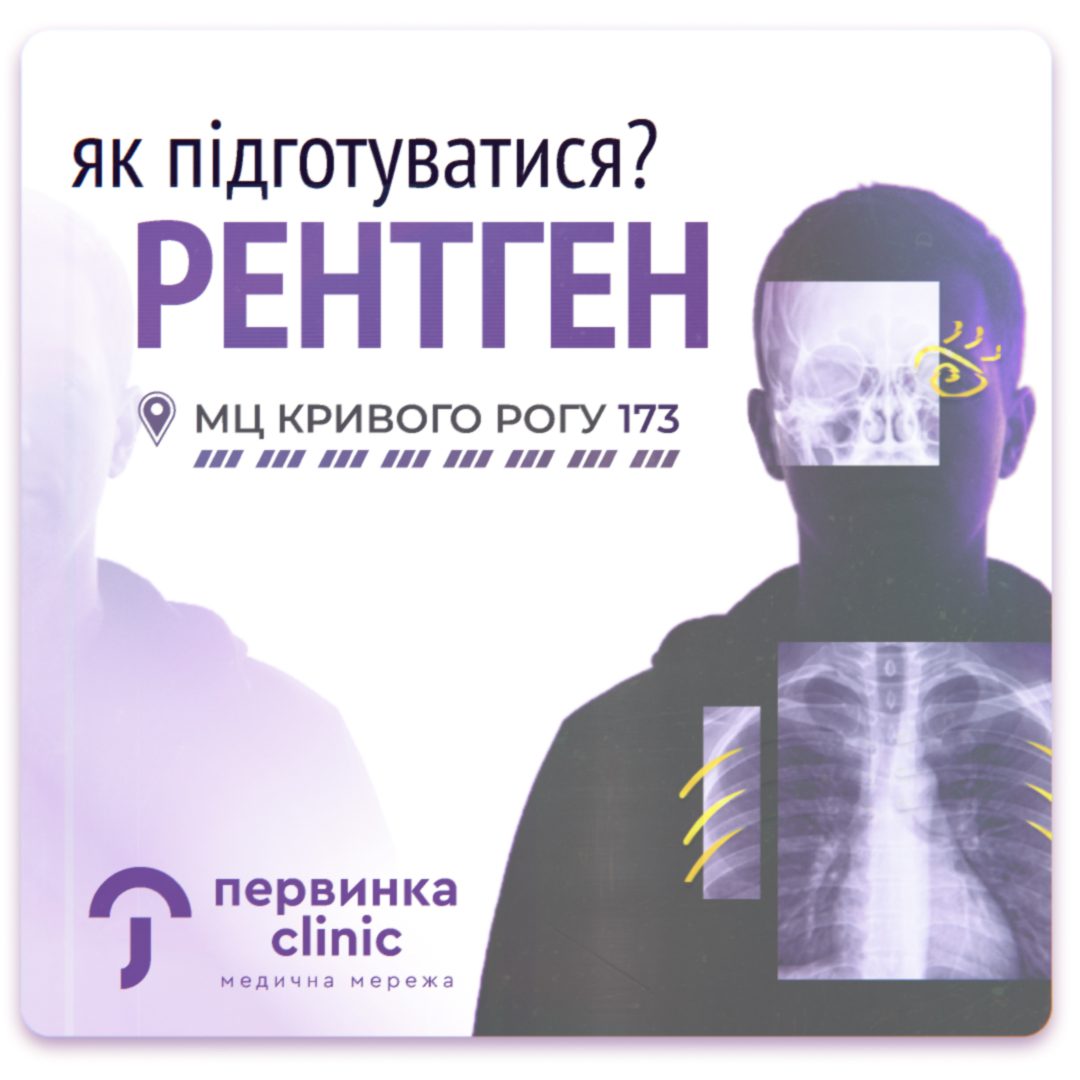 Обкладинка медичної мережі "Первинка". Як підготуватися до рентгенографії? Що потрібно перед тим як зробити рентген? Рентген у Кривому Розі на 173 кварталі