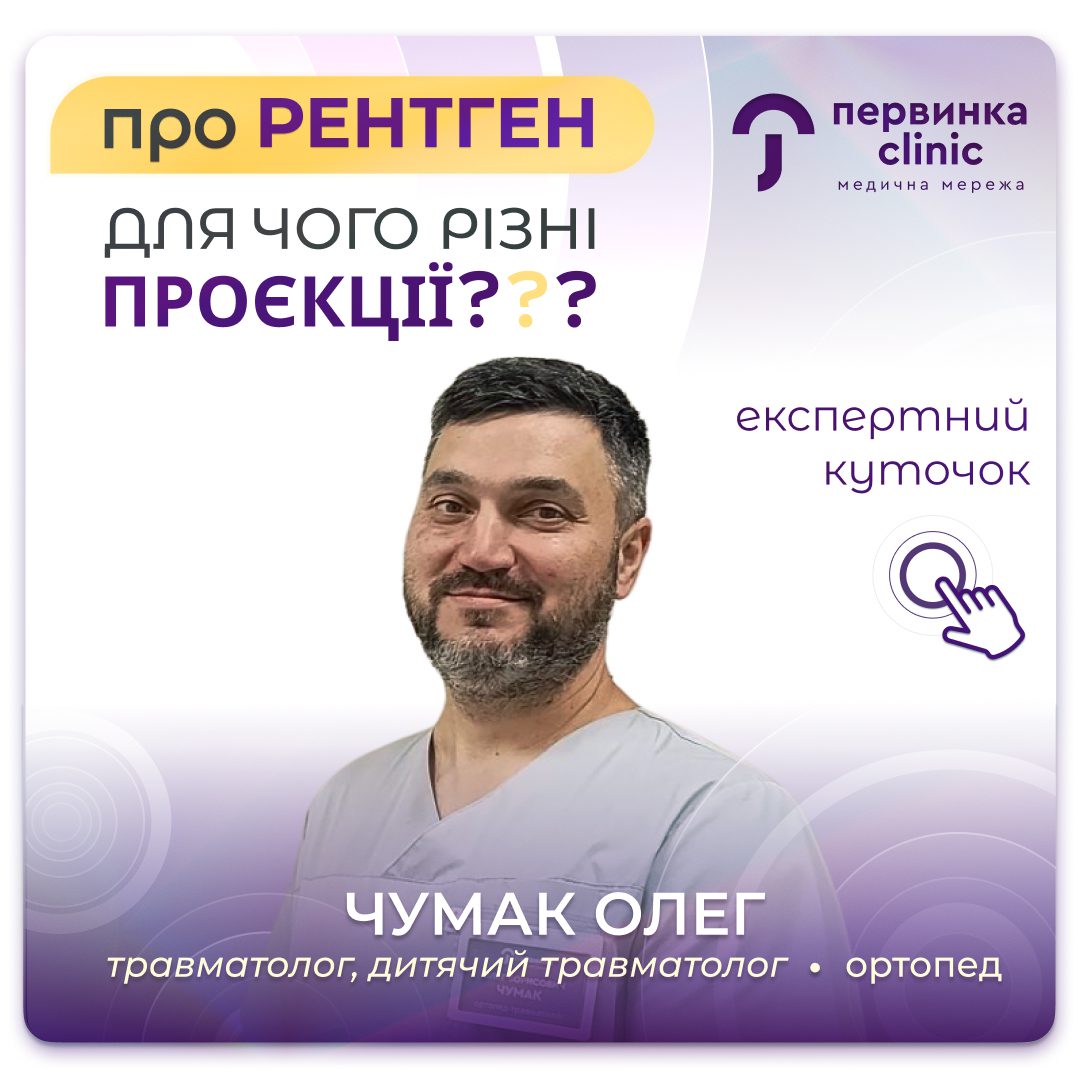 Обкладинка медичної мережі "Первинка". Про рентген. Для чого різні проекції? Провідний травматолог дорослий та дитячий у місті Кривий Ріг Чума Олег
